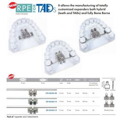 PALATAL EXPANDER 10mm FOR TAD